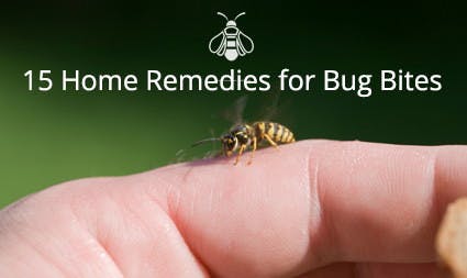 15 Cheap and Easy Home Remedies to Ease Insect Bites and Stings