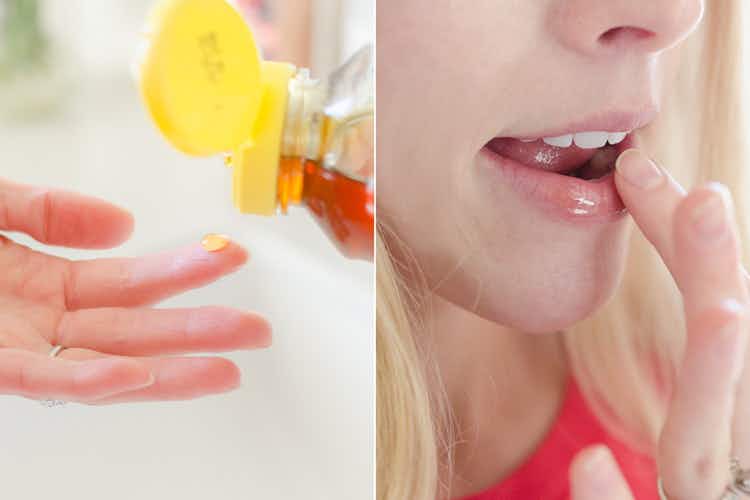 person applying honey to chapped lips