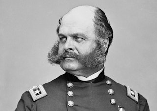 Hair loss embarrassing