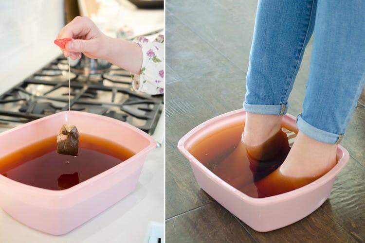 Someone soaking their blistered feet in warm black tea to reduce infection.