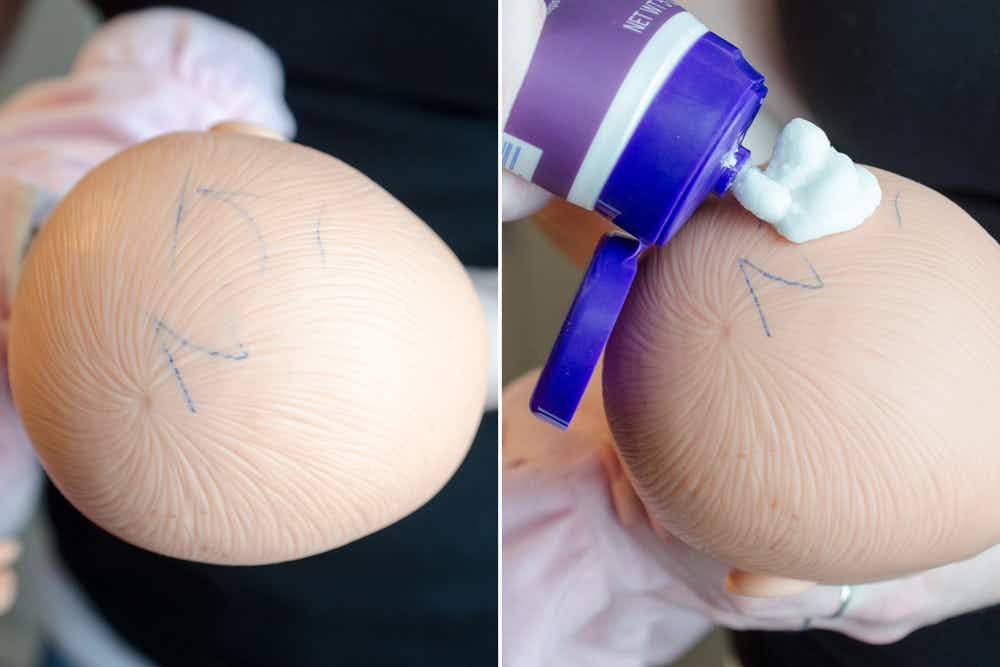 Remove ink stains from plastic dolls with pimple cream. 