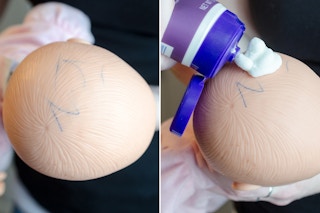 Remove ink stains from plastic dolls with pimple cream.