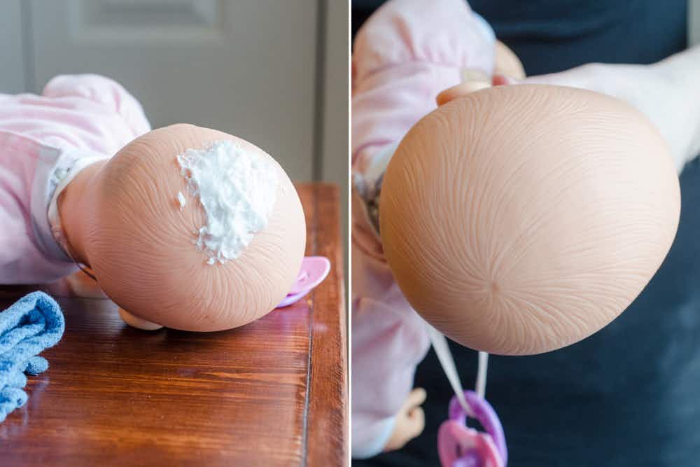 Remove ink stains from plastic dolls with pimple cream. 
