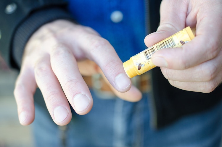 A person applying Chapstick to their dry cracked fingers