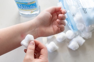 20181212 kcl witch hazel hacks bug bites 01 1544826353