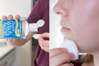 20181212 kcl witch hazel hacks control blemishes 03 1544826724