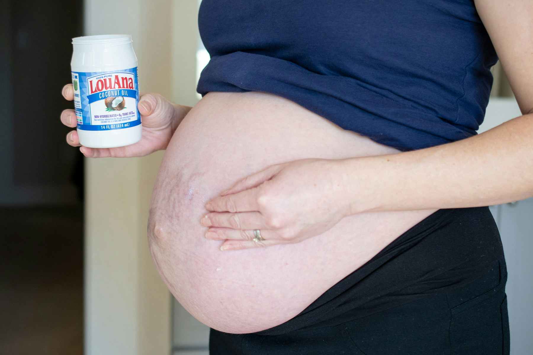 A pregnant woman rubbing coconut oil onto her stomach.