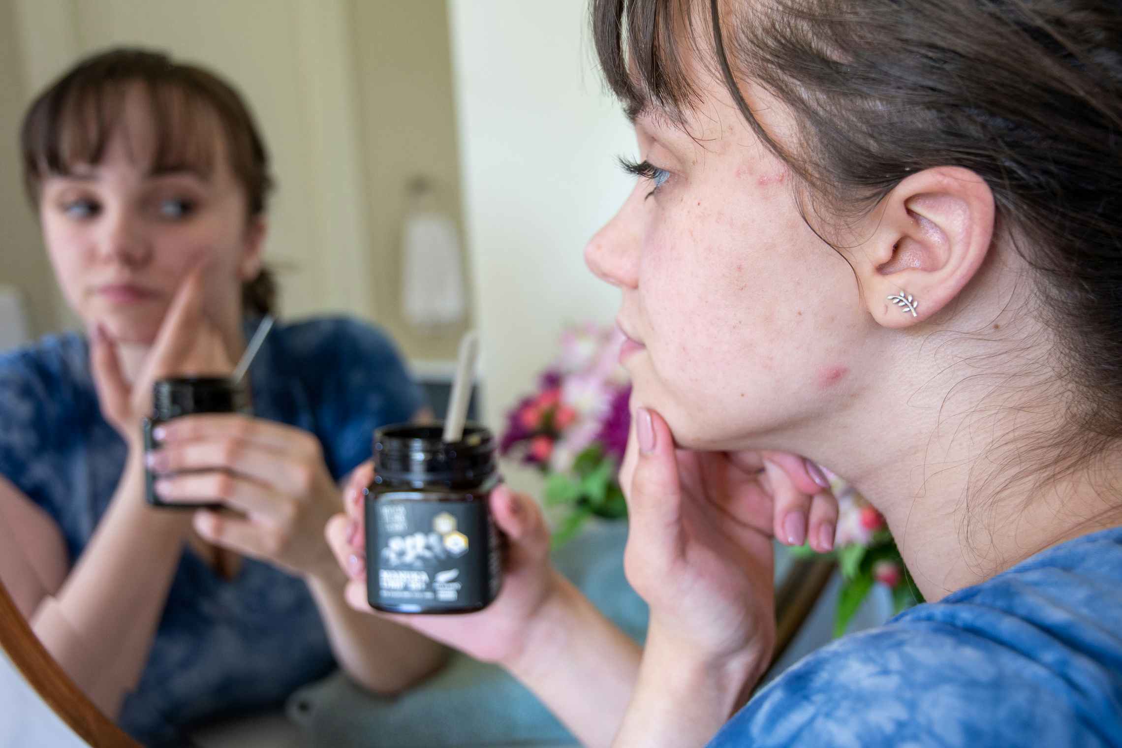 A woman with mild acne looking in a mirror, holding a jar of Manuka Honey.