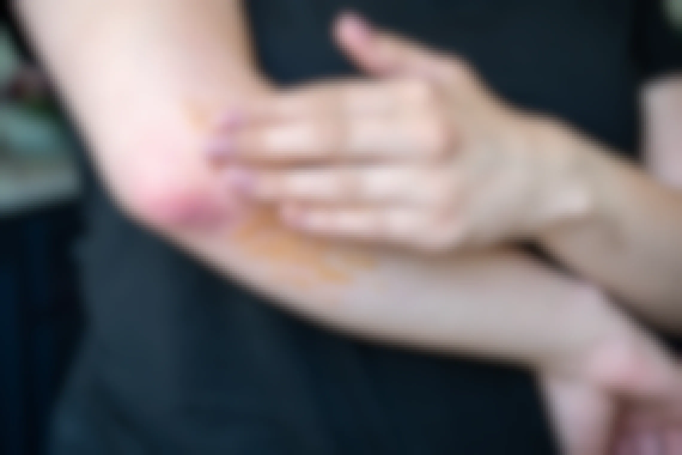 A woman applying Manuka honey to a rash on her elbow.