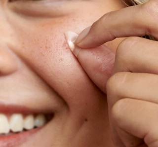 Avarelle Pimple Patches