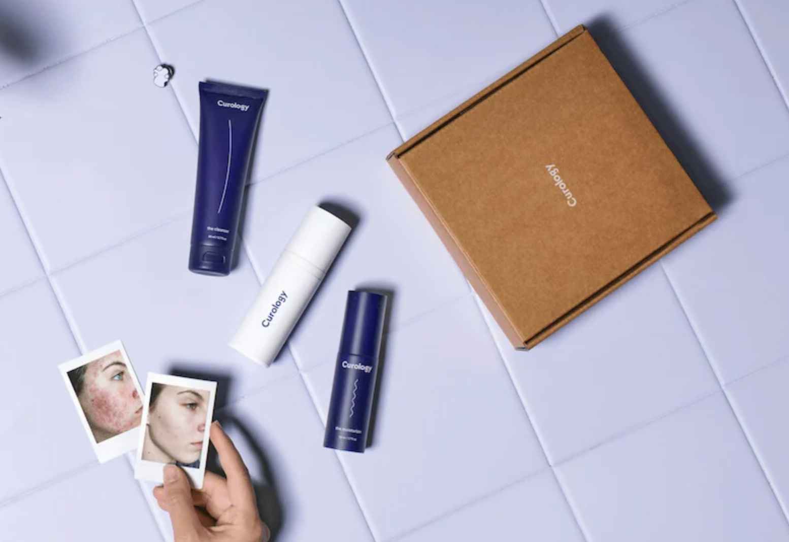 a woman holding before and after photos next to curology skin scare products on a tile floor