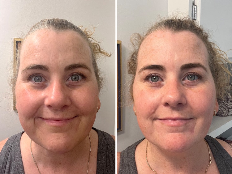 before-and-after of someone's face after using olay collagen peptide 24 max face moisturizer