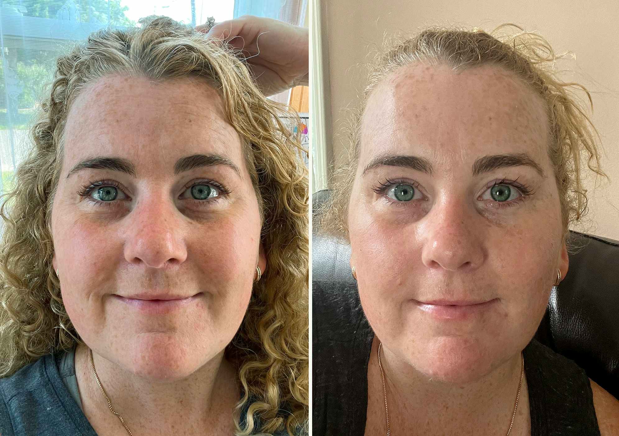 before and after photos of someone who had used olay total effects skincare products